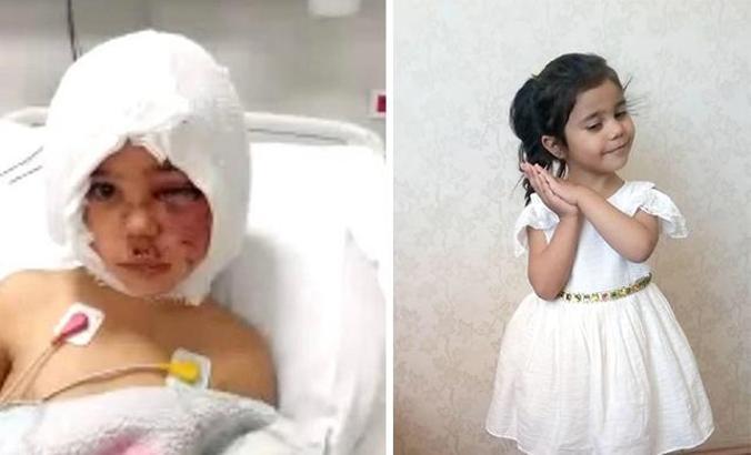 Pitbull saldırısında yaralanan Asiye'ye ikinci ameliyat 1 hafta sonra