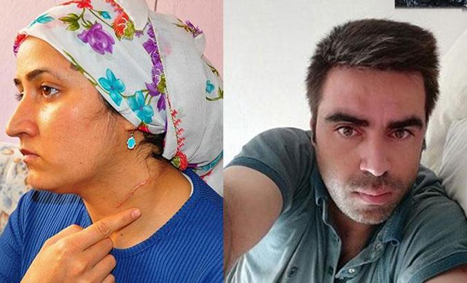 Eşi tarafından boğazı falçatayla kesilerek yaralanan Esra'ya haciz şoku