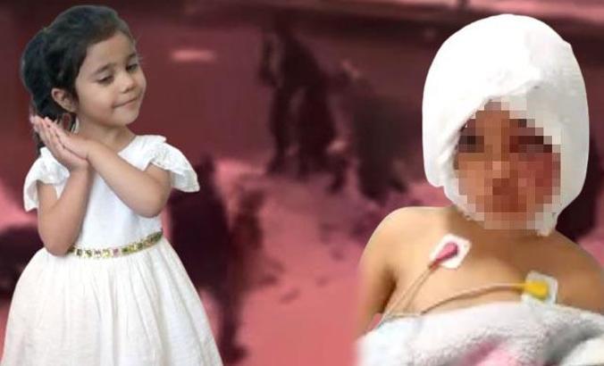 Pitbull saldırısı sonrası doku nakli yapılan Asiye'den sevindiren haber!