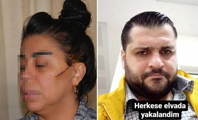 Eski sevgilisinin yüzünü ustura ile kesen şüpheli, tutuklandı