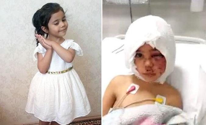 Pitbull saldırısında yaralanan Asiye'ye doku nakline başlandı