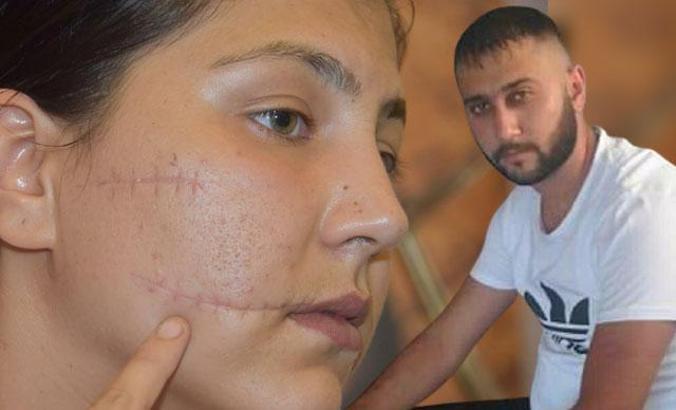 Eşini 104 yerinden bıçaklayan sanığa 20 yıl hapis istemi