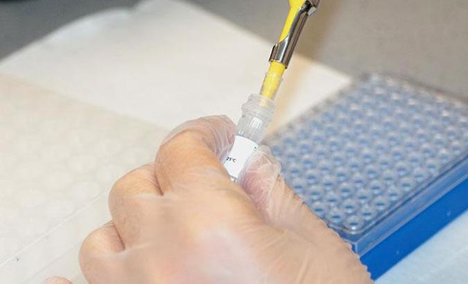 'Gen mutasyonu' kaynaklı obezite hastaları için geliştirilen ilaç insan denemesinde