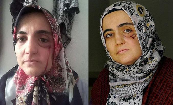 FETÖ'den hükümlü Ayşe Özdoğan’ın cezasının infazı 3 ay ertelendi