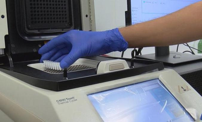 TÜSEB'in doğruluk oranı yüzde 100'e yakın yeni PCR tanı kiti yolda