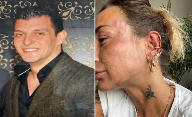 Uzaklaştırma kararına rağmen otomobilde eski sevgiliye dayağa tutuklama