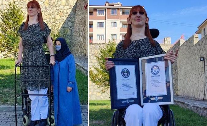 Dünyanın en uzun kadını Rumeysa: Farklı olmak kötü bir şey değil