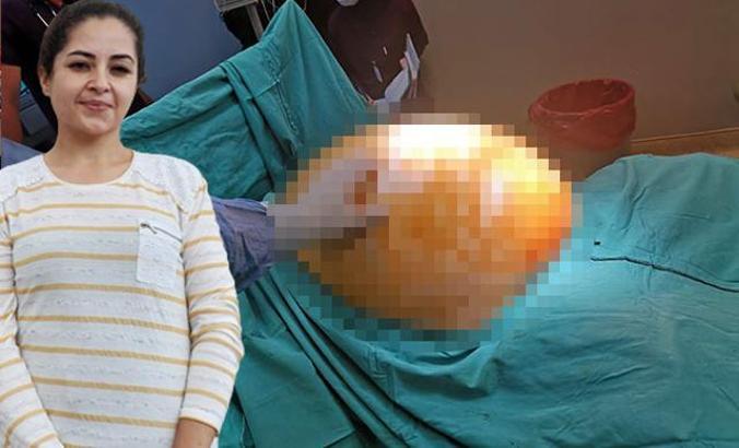 Tümör alınınca 91 kilodan 70 kiloya düştü
