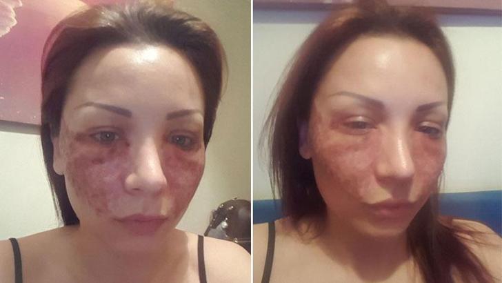 Bulgar modelin estetik kabusu; kuaför kardeÅŸler: Örümcek ağı yapmadık, iftira