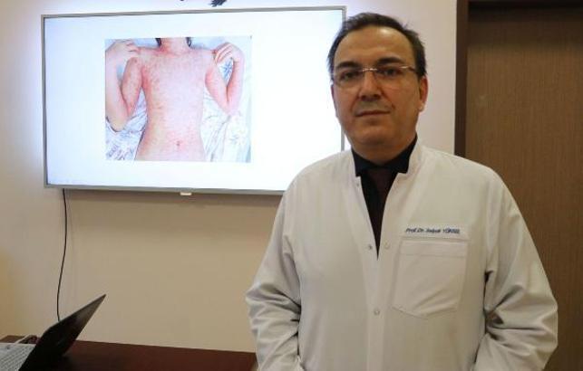 Prof. Dr. Selçuk Yüksel: Covid-19 çocuklarda saklı virüsleri tetikliyor