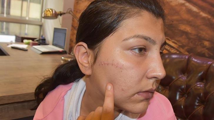 Mahkeme heyetinin kadın üyeleri, salonu boşaltıp Perkgün'ün yara izlerini inceledi