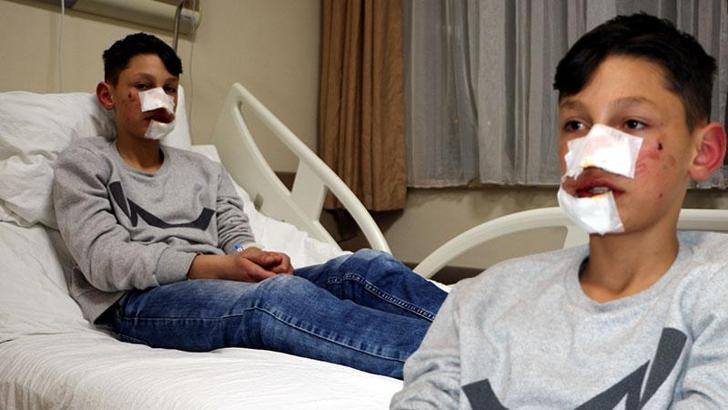 Ekmek almaya giden Berat, sokak köpeğinin saldırısıyla yaralandı