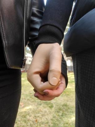 'Pençe-Şimşek' gazisine biyonik kol takıldı