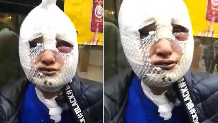 Eski sözlüsünün başından aşağı kızgın yağ döken sanığa tahliye