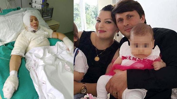 Elvan'ı yakan eski eşi: Olay kazayla oldu