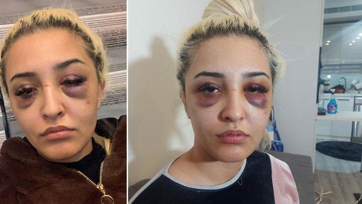 Eski sevgilisinden 3 saat şiddet gören Gamze, şikayetini geri çekti