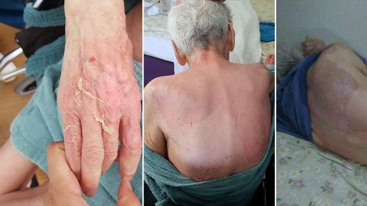 Huzurevindeki banyo sonrası ölümde tanık hemşire: Yanık olsa su toplardı