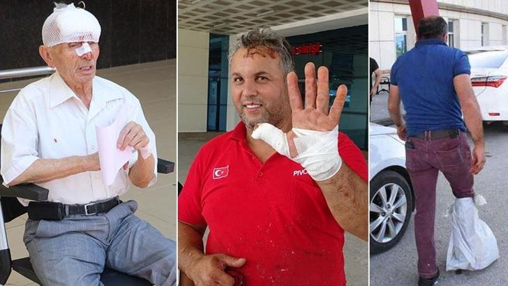 Yurt genelinde 5 bin 102 acemi kasap hastanelik oldu