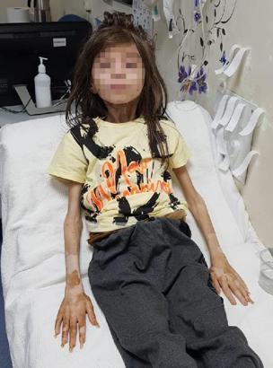 Boşaltılmak istenen çöp evde 1 yıldır odaya kilitli çocuk baygın bulundu