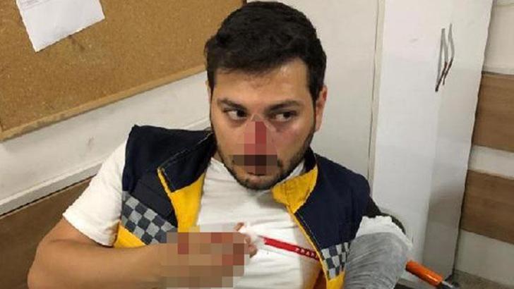 Şanlıurfa’da trafikte yol tartışmasında ambulans şoförünün burnu kırıldı: 1 gözaltı