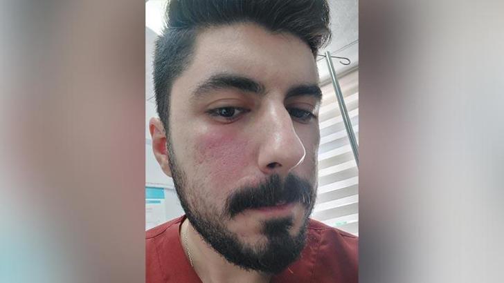 SaÄŸlık çalışanlarını darbettiÄŸi iddiasıyla gözaltına alındı
