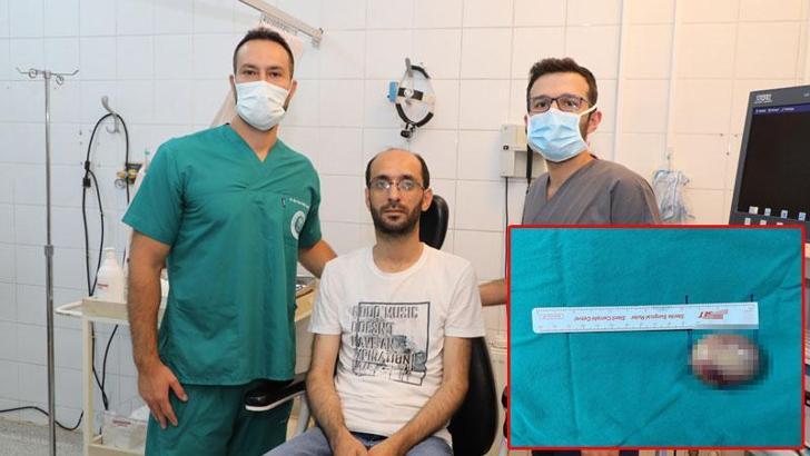 Gırtlağından yumruk büyüklüğünde kitle çıktı, dünyada ilk oldu