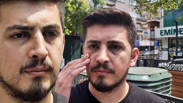 Hemşirenin burnunu kıran hasta yakını bu kez tutuklandı