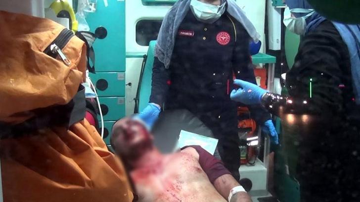 Sokakta karşılaştığı husumetlisini tabancanın kabzasıyla başından yaraladı