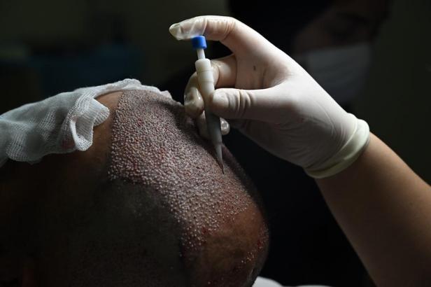 “Türkiye estetik cerrahide referans ülke konumunda”