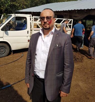 Hacze giden avukatı ısırmanın cezası 2,5 yıldan 4 yıla çıkarıldı