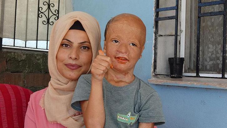 8 yaşındaki Halil'e 3'üncü kez doku nakli yapılacak