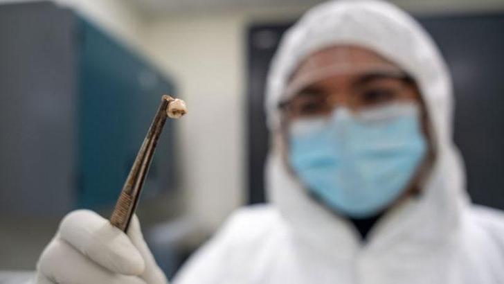 Araştırma: Kara Ölüm salgını, bağışıklık sisteminin evrimini şekillendirdi