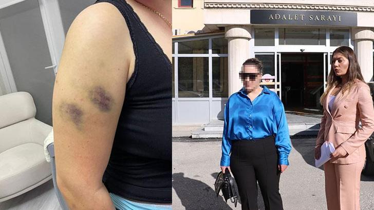 Kendisini darbettiği iddiasıyla avukat kocası hakkında suç duyurusunda bulundu