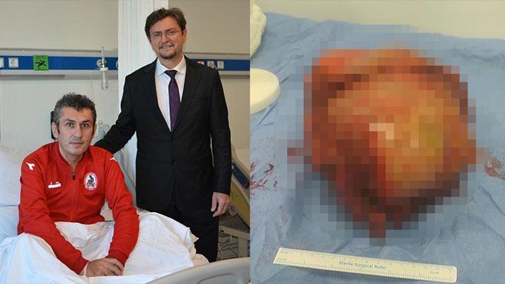 Göğüs ağrısı şikayetiyle gittiği hastanede vücudundan 6 kiloluk kitle çıkarıldı