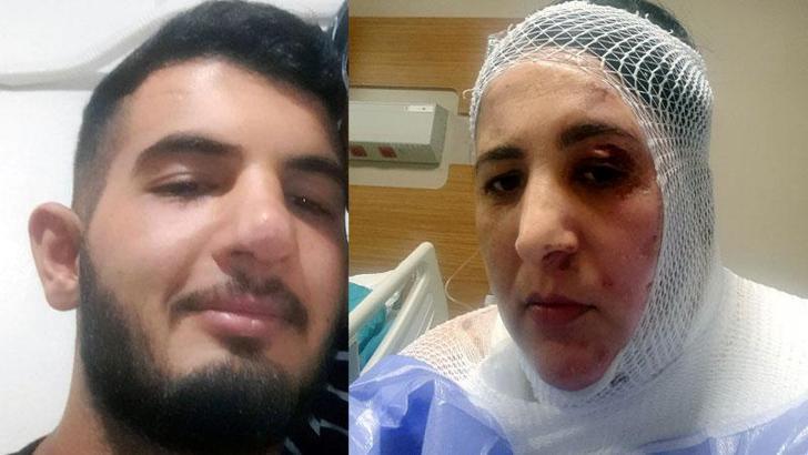 Üvey annesine kezzapla saldıran şüpheli tutuklandı