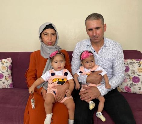 Tek yumurta ikizleri, anne karnında müdahaleyle tedavi edildi