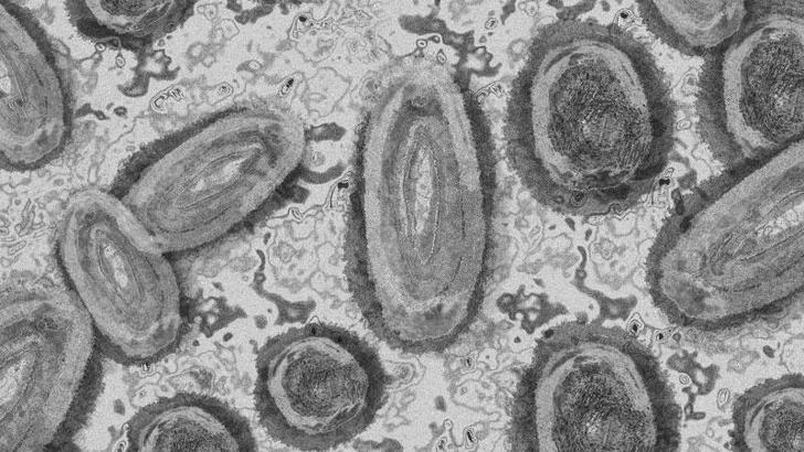 AB Komisyonu, 2 milyon doz maymun çiçeği aşısı aldığını açıkladı
