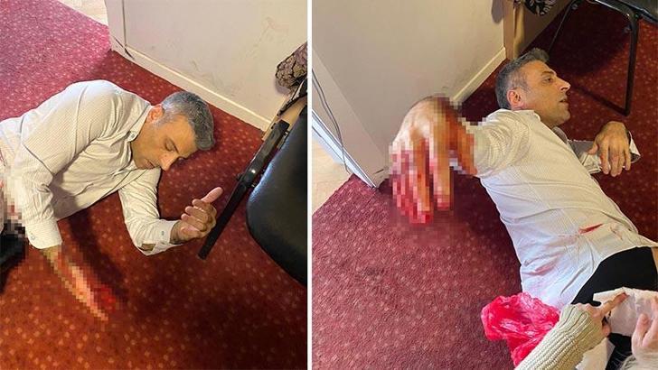 Yenilik Partisi Genel Başkanı Öztürk Yılmaz, bıçaklı saldırıda yaralandı