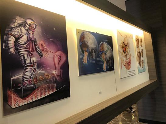 Ameliyatlarını çizen doktorların eserleri sergilendi