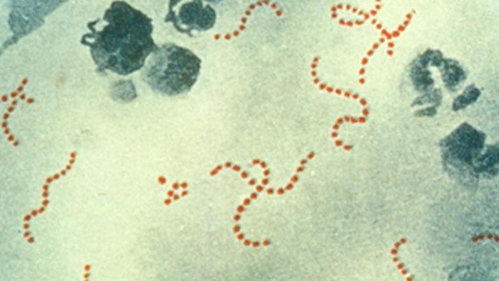 İngiltere’de Strep A’ya bağlı ölümler 122’ye ulaştı