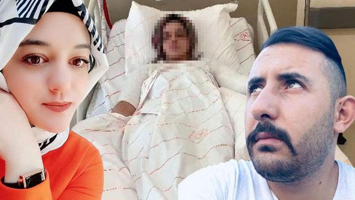 Eski nişanlısının yüzüne kimyasal atan sanık: Susturmak için yaptım