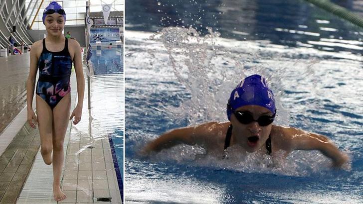 Doğuştan bedensel engelli Türkiye şampiyonu İrem, 6 yılda 14 madalya kazandı