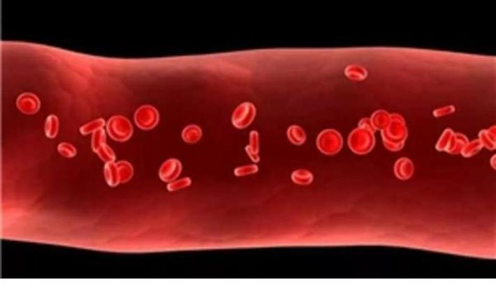 Doç. Dr. Topçu: Kan pıhtılaşmasının nedenleri arasında kanser ikinci sırada