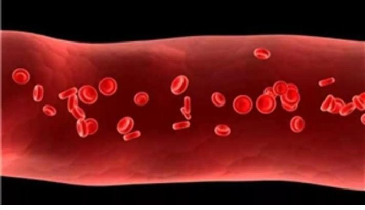 Doç. Dr. Topçu: Kan pıhtılaşmasının nedenleri arasında kanser ikinci sırada