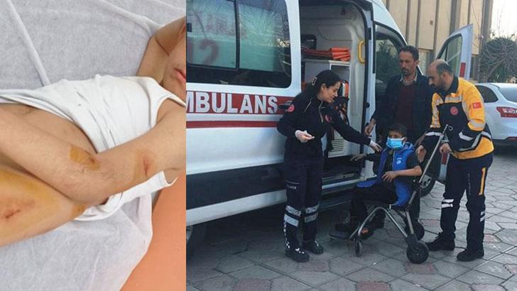 Köpeğin saldırdığı çocuk yaralandı