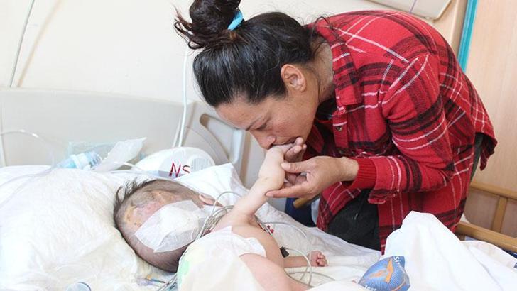 Hidrosefali hastası depremzede bebek, Antalya'da ameliyat edildi