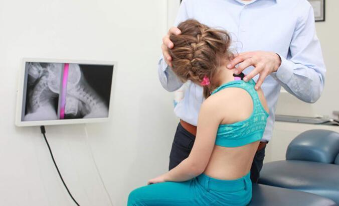 Skolyoz tedavisinde yeni yöntem; 'ipli tedavi'