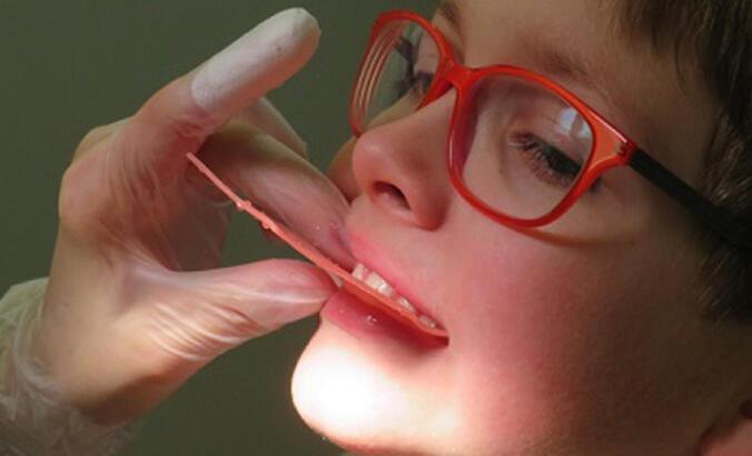 Uzmanı uyardı: Çocuklarda çürüyen süt dişlerinin takibi yapılmalı