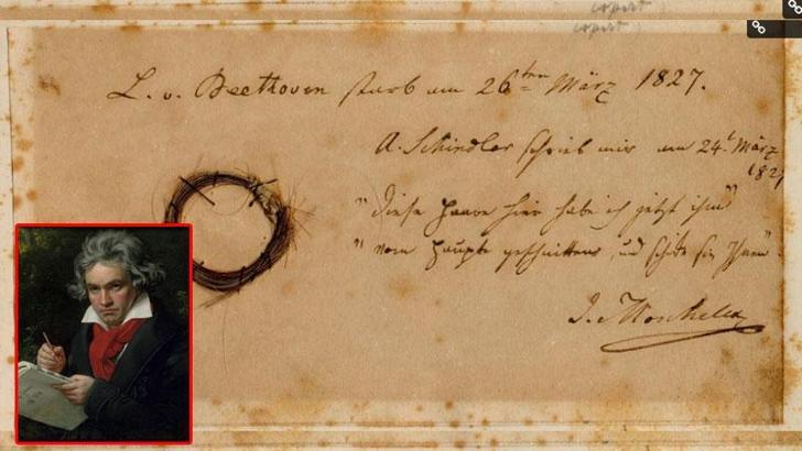 Beethoven’ının saç telleri incelenerek sağlığı hakkında bilgiler elde edildi