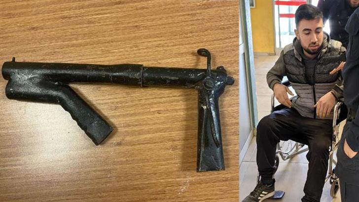 Yol kenarında bulduğu düzenek ateş aldı, bacağından yaralandı